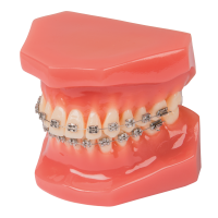 paro® Bracket-Modell,1 Stk.